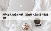 脚气怎么治疗能除根（脱皮脚气怎么治疗能除根）