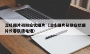 湿疹图片初期症状图片（湿疹图片初期症状图片长春肤康电话）