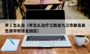 早玴怎么治（早怎么治疗江西省九江市都昌县思源学院楼业园区）