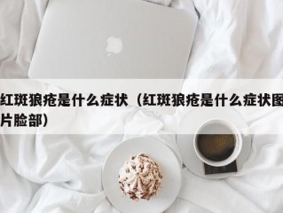 红斑狼疮是什么症状（红斑狼疮是什么症状图片脸部）