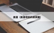 跳蚤（跳蚤咬后的症状图）