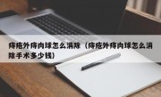 痔疮外痔肉球怎么消除（痔疮外痔肉球怎么消除手术多少钱）