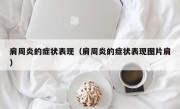 肩周炎的症状表现（肩周炎的症状表现图片肩）